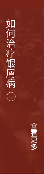如何治疗银屑病
