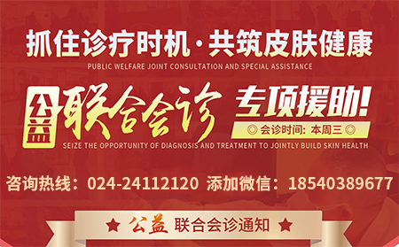 4月19日沈阳市中北医院举行银屑病公益联合会诊专项援助活动