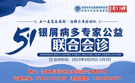 五一银屑病多专家公益联合会诊在沈阳中北银屑病医院举行