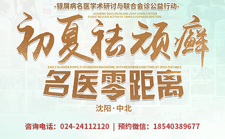 沈阳中北银屑病医院周六、周日开展“初夏祛顽癣·名医零距离”银屑病名医联合会诊