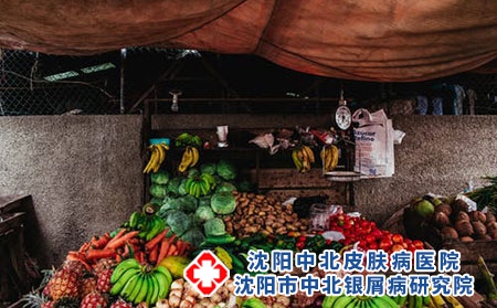 沈阳中北银屑病研究院治疗效果好吗?
