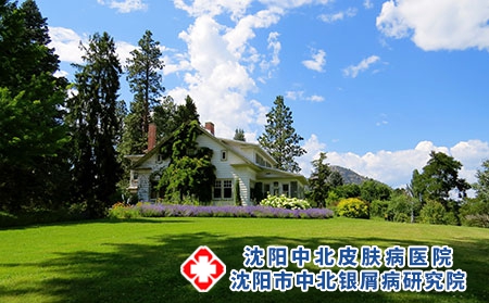 头部银屑病如何治?护士节来沈阳中北银屑病研究院