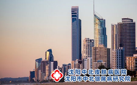 选择沈阳中北银屑病研究院治疗怎么样?