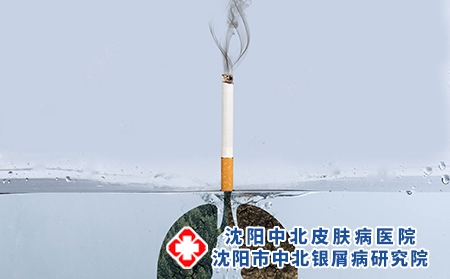 沈阳中北银屑病研究院呼吁银屑病患者世界无烟日银屑病患者戒烟