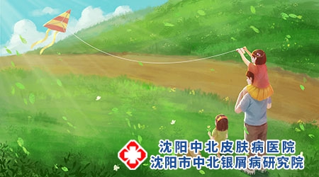 春发银屑病，避免五个关键点！