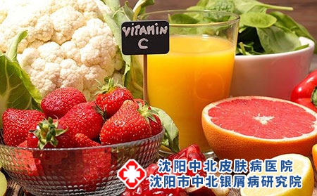点滴型银屑病头上脸上有干皮怎么治，如何缓解点滴型银屑病头上脸上干皮