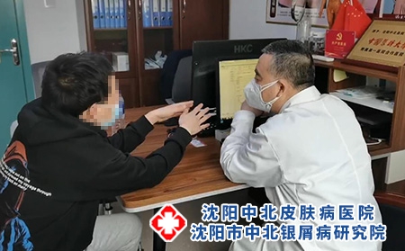 沈阳银屑病生物制剂