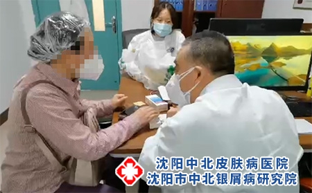 推荐:沈阳哪里可以测牛皮癣[准确]沈阳检查牛皮癣哪家医院好[排名前列]