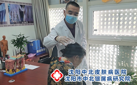 [推荐]沈阳哪家医院专门治疗牛皮癣[排名前列]沈阳专看牛皮癣病的医院[前五]