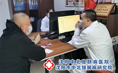 沈阳银屑病医院哪家好?沈阳中北银屑病医院值得信赖