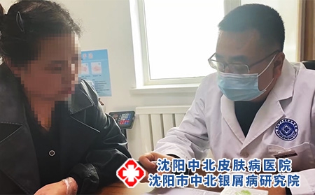 沈阳银屑病有哪些医院-沈阳银屑病医院排行榜十大品牌「重点医院排名」品牌响亮!