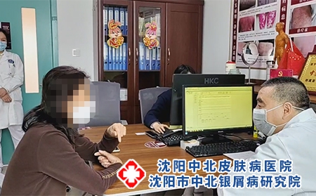 公开发布!沈阳中北银屑病医院的位置「排名实时公开」沈阳哪个医院银屑病看得好些-晚期牛皮癣症状表现是什么?