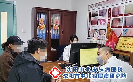 银屑病初期小红点图片