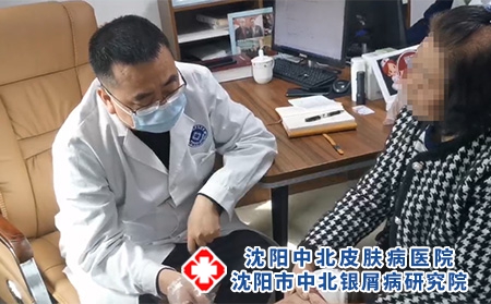 沈阳银屑病专科医院沈阳中北医院