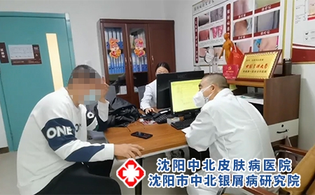 沈阳治效果好银屑病哪家医院-沈阳治疗银屑病专业的中医院-牛皮癣是什么原因引起的