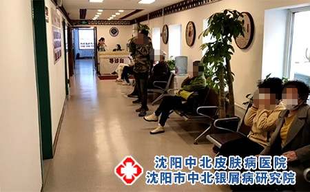 人们患上牛皮癣应该怎样饮食呢