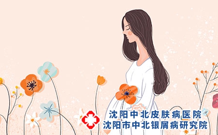 产后牛皮癣康复期间要注意什么呢?