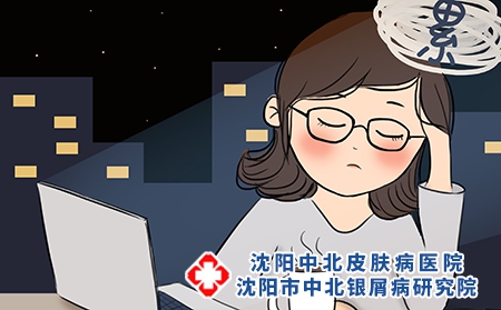 银屑病偏方秘药不可信，规范治疗才长久