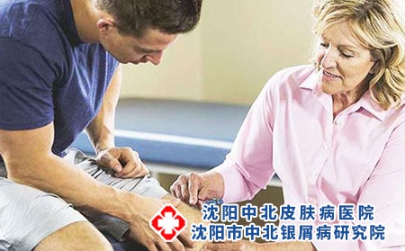 中年牛皮癣治愈率 患有牛皮癣该如何进行治疗