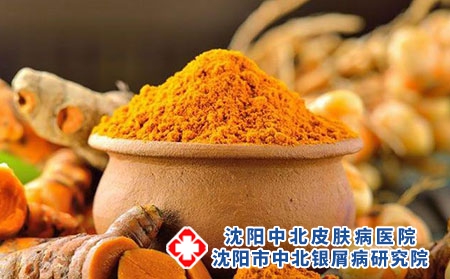 银屑病不复发用忌口吗?