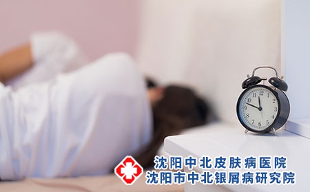 生活习惯上如何抑制牛皮癣?