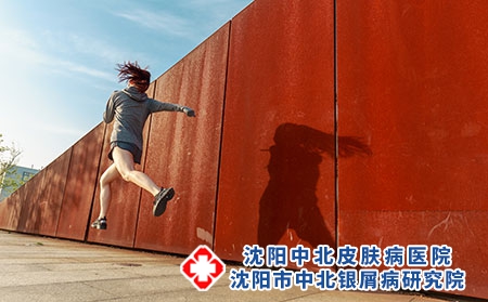 良好的心理状态能促进银屑病康复