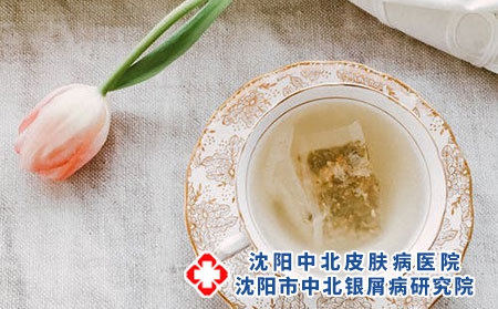 银屑病患者可以喝茶吗?
