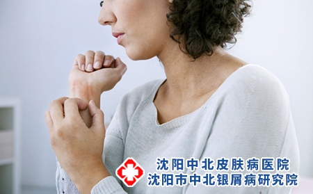 银屑病用药患者要关注的问题有什么?