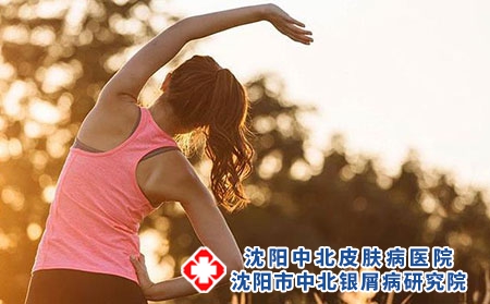 牛皮癣病人是不是要多出汗