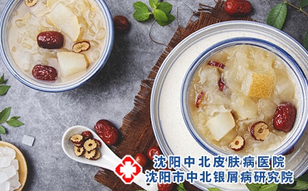 牛皮癣的食疗方法有哪些