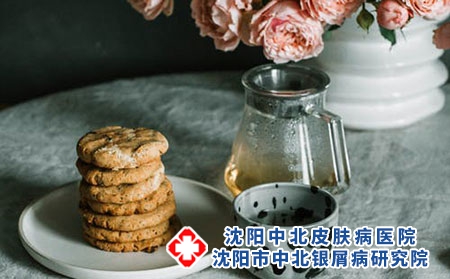 银屑病患友的这些经验，可能对你的康复有帮助!