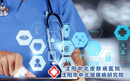 为什么牛皮癣会越治越严重？