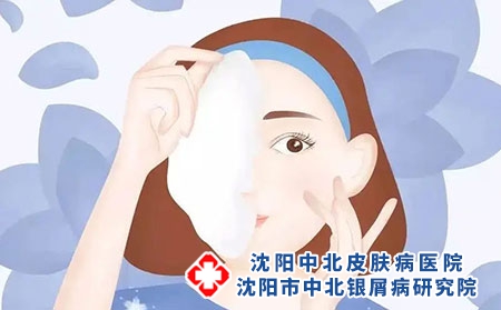 银屑病爬上脸部，别怕!有救啦!沈阳银屑病医院