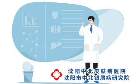 银屑病和免疫力相关，如何巩固免疫力?沈阳银屑病医院，沈阳牛皮癣医院，沈阳皮肤病医院