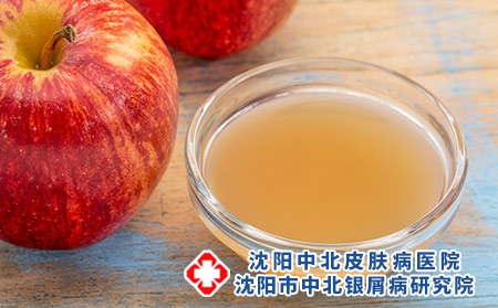 摄图网_304211345_与母亲一起生苹果醋一个小玻璃碗有新鲜的红苹果（企业商用）