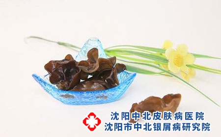 冬季银屑病患者如何进行养生避免病情反复?养生攻略值得收藏!沈阳银屑病医院