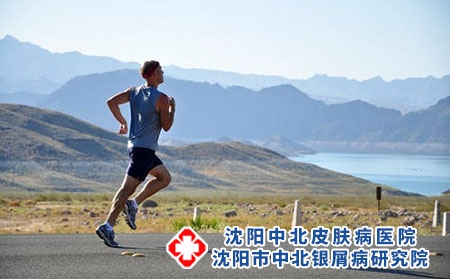 银屑病与免疫系统有关，增强免疫力有哪些作用?沈阳银屑病医院，沈阳牛皮癣医院
