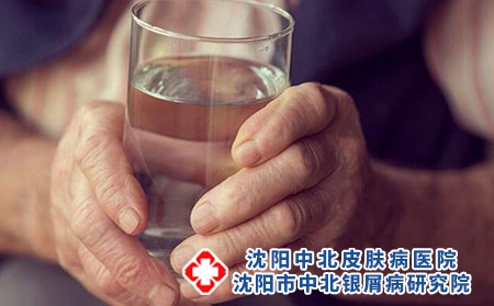 如何避开牛皮癣治疗误区 四种误区一定要知道