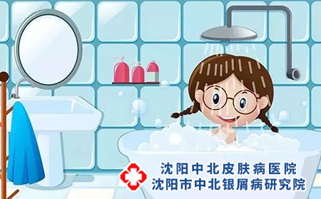 儿童牛皮癣到底能否恢复呢?恢复的几率又是多少呢?