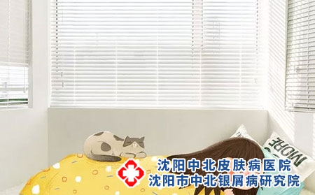 银屑病会遗传给宝宝吗?沈阳银屑病医院，沈阳牛皮癣医院，沈阳皮肤病医院