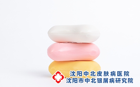 牛皮癣患者洗护常识 牛皮癣患者能用肥皂吗