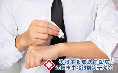 沈阳老年牛皮癣患者应做的保健