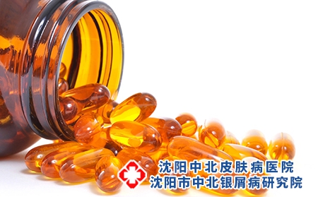 牛皮癣患者可以吃什么营养品恢复疾病吗?