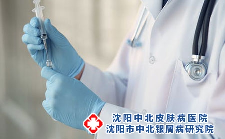 银屑病治好了可以停药吗