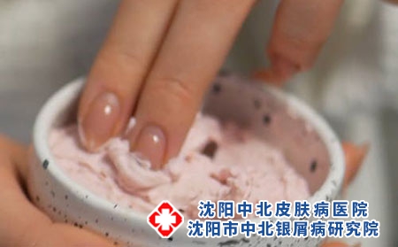银屑病多年未愈，你还在滥治疗吗?沈阳银屑病医院，沈阳牛皮癣医院，沈阳皮肤病医院