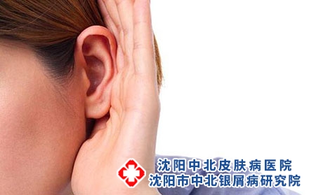 男人牛皮癣发病机理 早日康复生活好