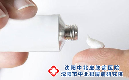 治疗银屑病的糖皮质激素类药膏有哪些