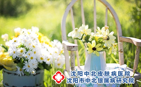 紫外线照射对银屑病关节炎有哪些作用?