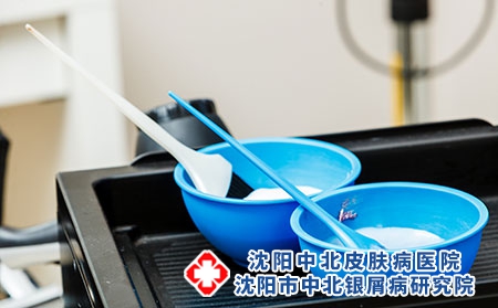 银屑病患者想染发，怕过敏?这些方法帮你解决!沈阳看银屑病，沈阳银屑病医院，沈阳牛皮癣医院，沈阳皮肤病医院