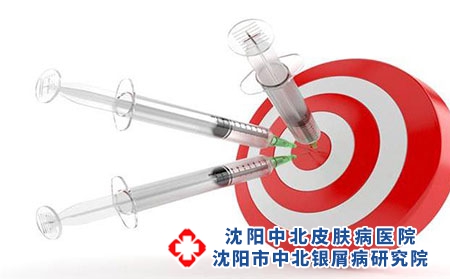 沈阳银屑病生物制剂，带你重获健康肌肤!